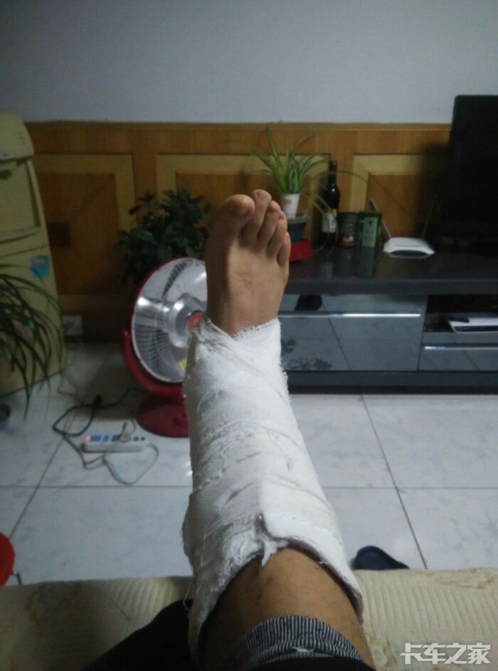 是啊,在家养伤!