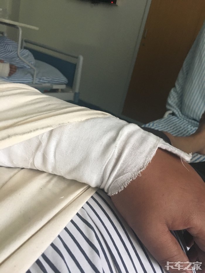 一不小心,在车上掉下来把胳膊摔断了